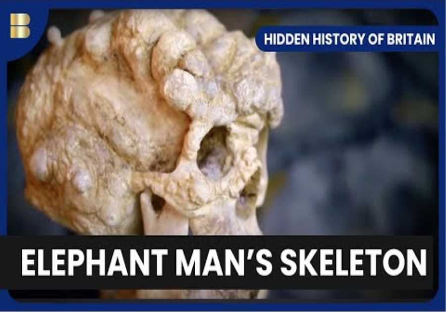 From Jack the Ripper to Joseph Merrick - Hidden History of Britain - S01 EP01 - History Documentary